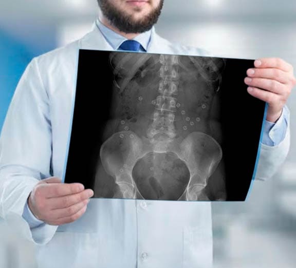 Aparelho para Manometria Esofágica de Alta Resolução - Deglutição