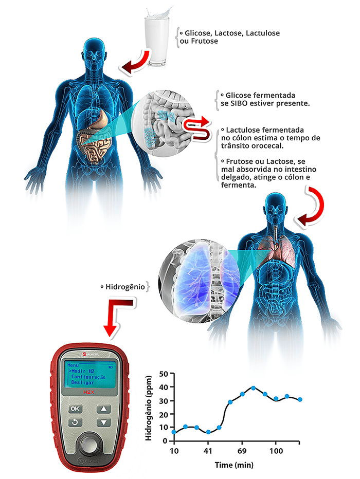 Teste Respiratório de Hidrogênio Expirado